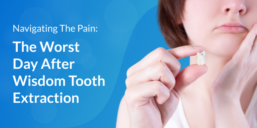 Navigating The Pain: The worst day of pain after wisdom tooth extraction