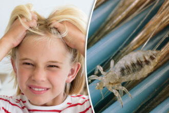 Rushed, Embarrassed, Exhausted: Why Parents Search ‘Lice Removal Near Me