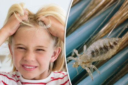 Rushed, Embarrassed, Exhausted: Why Parents Search ‘Lice Removal Near Me