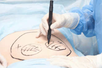 Cosmetic Surgery in Turkey
