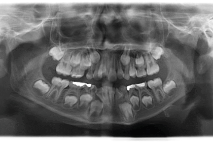 Toothprints of Time: How Dentists Decode Age, Diet, and Identity