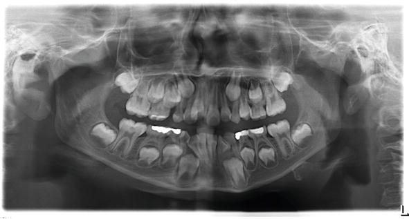 Toothprints of Time: How Dentists Decode Age, Diet, and Identity