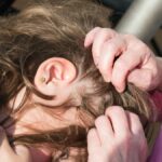 When the Scalp Becomes a Battlefield: What Lice Teach Us About Human Resilience