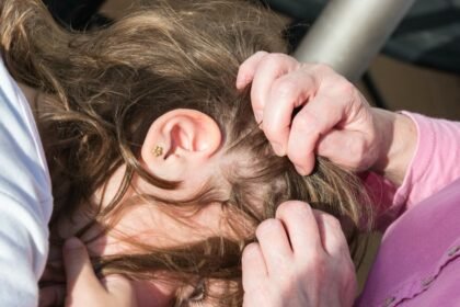 When the Scalp Becomes a Battlefield: What Lice Teach Us About Human Resilience
