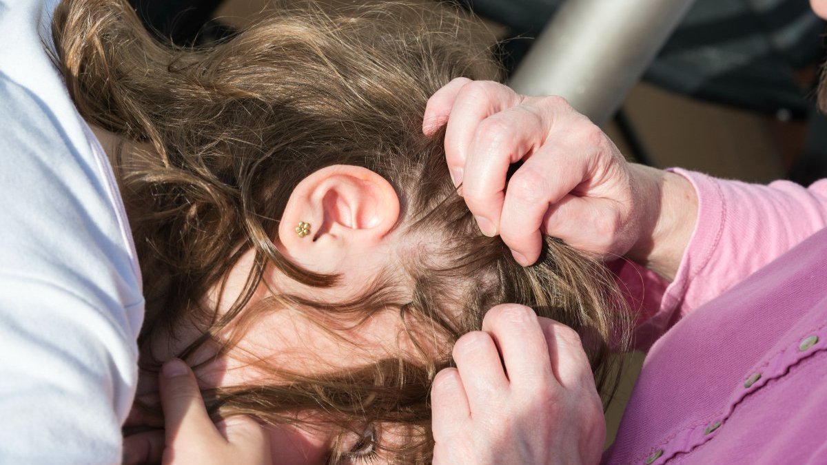 When the Scalp Becomes a Battlefield: What Lice Teach Us About Human Resilience