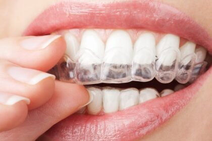 Invisalign