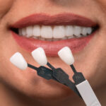 Avoid Veneer Tech: Why You Should See a Cosmetic Dentist Instead