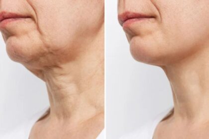 The Science Behind Cellulogia: How It Works and Its Benefits
