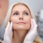 Facelift Surgery