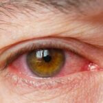 Everything You Need to Know bělmo