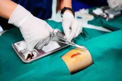 Limb Lengthening Surgery: What You Need To Understand