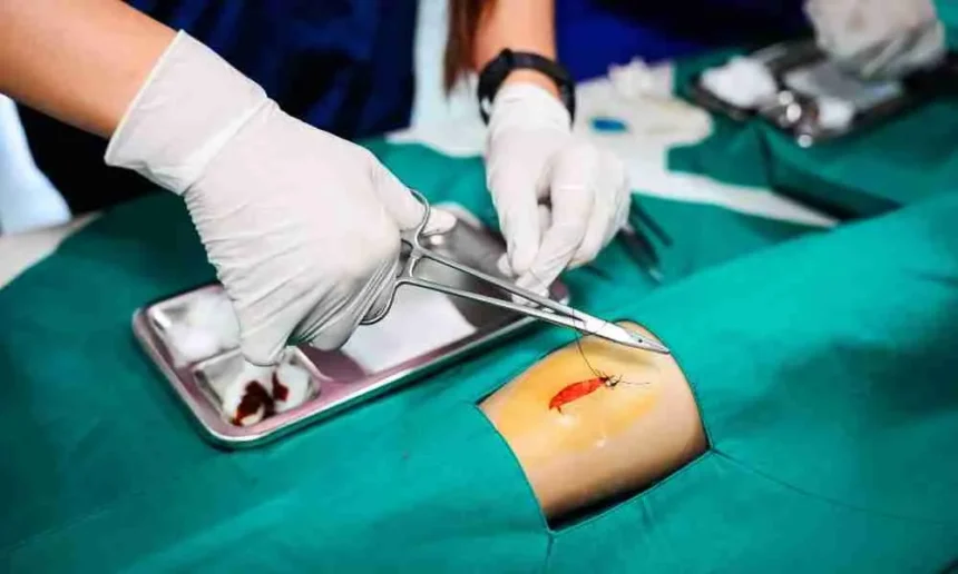 Limb Lengthening Surgery: What You Need To Understand