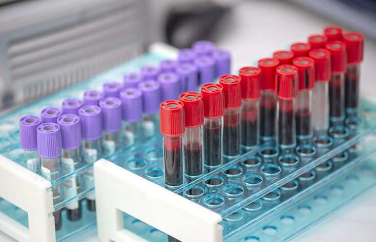 Serum Separator Tube: The Science Behind Accurate Blood Testing