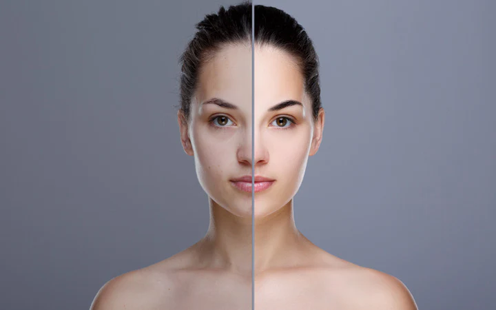From Dull to Dazzling: Treatments That Correct Uneven Skin Tone
