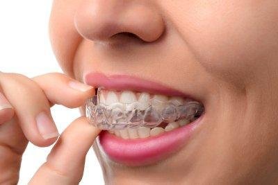 Best Invisalign Dentist NYC