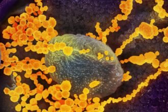 Everything You Need to Know Epcylon