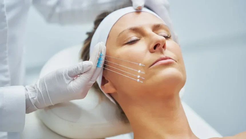 How Minimally Invasive Precision in Facelift Surgery in London (UK) Is Rewriting the Rules for Natural Results