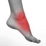 Everything You Need to Know Fotbladet