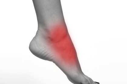 Everything You Need to Know Fotbladet