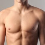 Top Surgery Scars