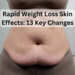 Rapid Weight Loss Skin Effects