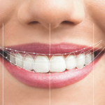 Everything You Need to Know Design of Smile​