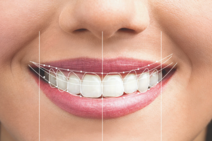 Everything You Need to Know Design of Smile​