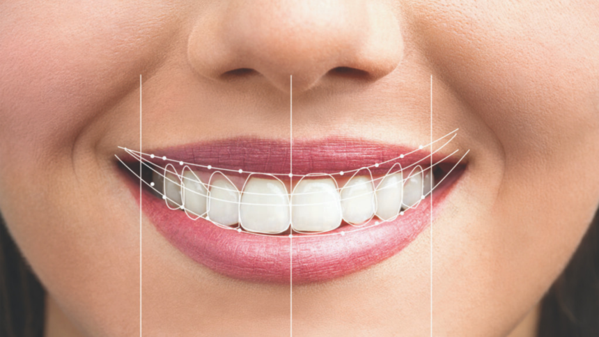 Everything You Need to Know Design of Smile​