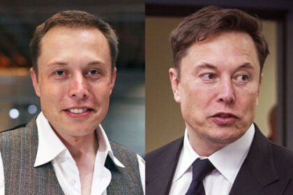 Elon Musk Hair Plugs​
