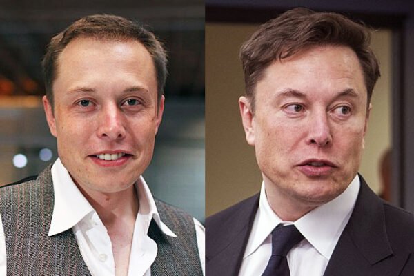 Elon Musk Hair Plugs​