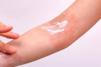 Step-by-Step Guide to Applying Eczedone Cream