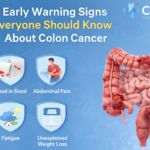 Colon Cancer