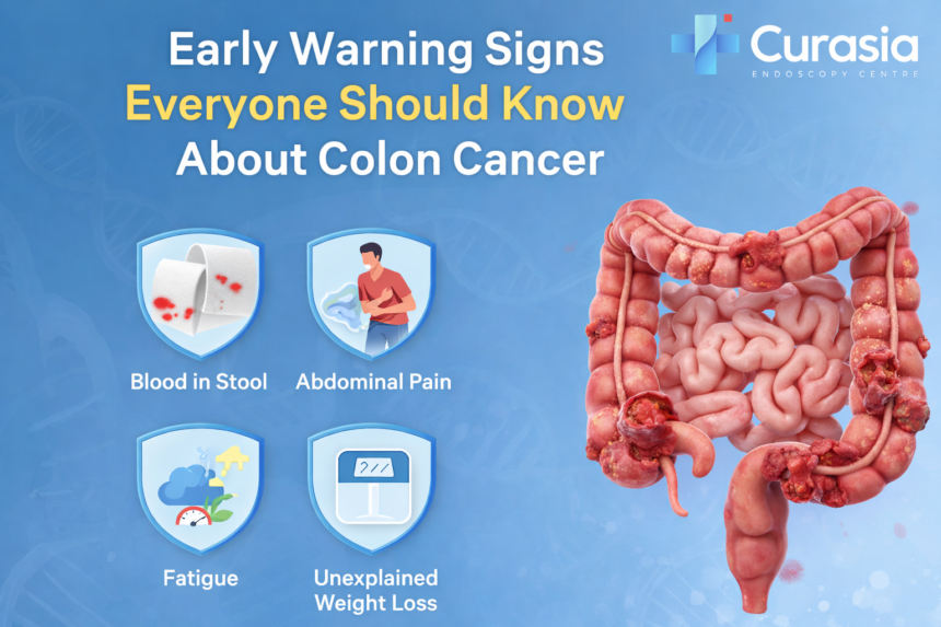 Colon Cancer