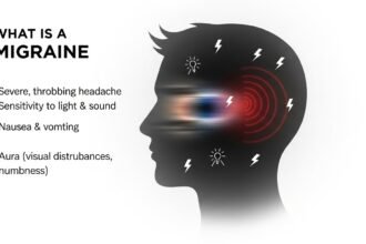 What Is a Migraine and How Is It Treated in the UK?