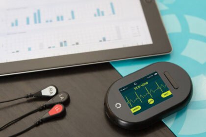 mobile cardiac telemetry